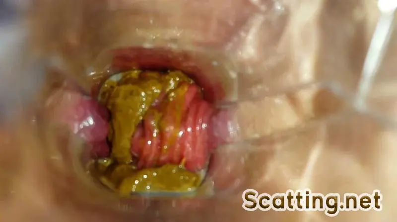 Anna Coprofield - Speculum Play and Filled Pussy part 1 (Scatology, Solo) Defecation [FullHD 1080p]