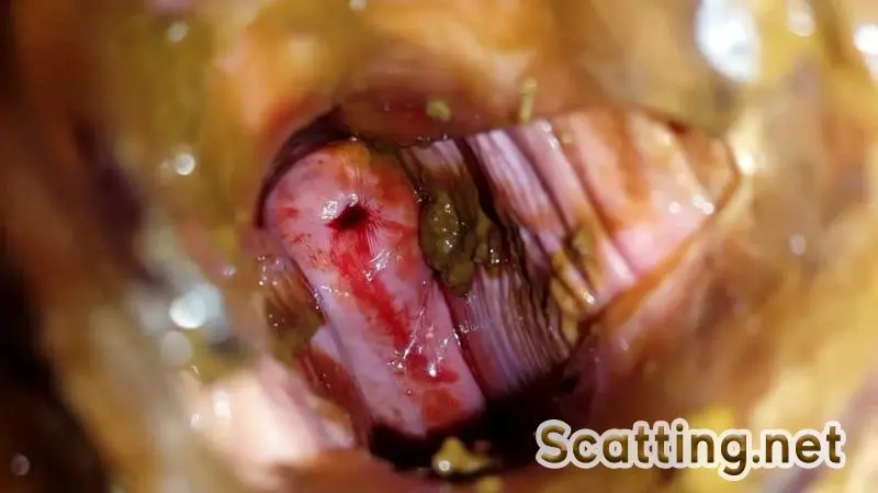 Anna Coprofield - Shit and Blood Vol.5 Speculum Full version (Slander, Bull, Solo) Poop Videos [FullHD 1080p]