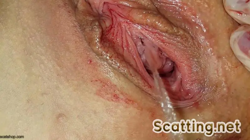 Anna Coprofield - Shit and Blood Vol.8 Speculum (Solo, Defecation) Poop Videos [FullHD 1080p]