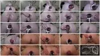Dirtygardengirl - Speculum Compilation (Scat, Solo) Dirty Anal [FullHD 1080p] Screenshot 1