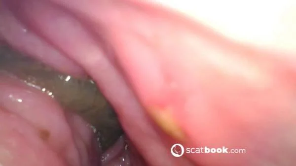 Sweet Tinqerbell - Endoscope In My Ass (Dildo, Anal) Scatbook.com [FullHD 1080p]