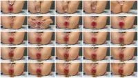Rosemia - Dirtiest Anus Prolapse Part 1 (Solo, Scat ) Scatbook.com [HD 720p]