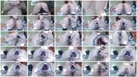 Sweet Tinqerbell - Gape With Big Speculum 2 (Dildo, Anal ) Scatbook.com [HD 720p]