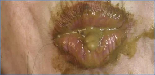 Dirtygardengirl Goes All Out with Fisting and Solo Scat in Shit Mistress Upclose Personal 1