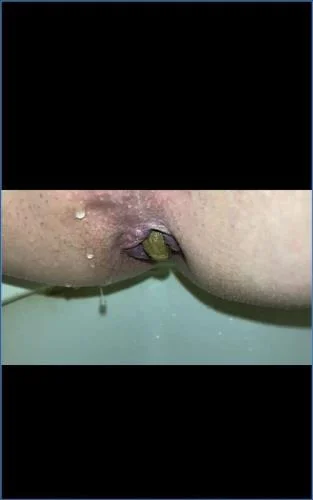 Missellie's Puking, Smearing, and Anal Play in Voyeur Scat Smearing