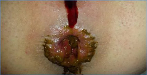 Anna Coprofield Fills the Toilet with Explosive Shit and Farts