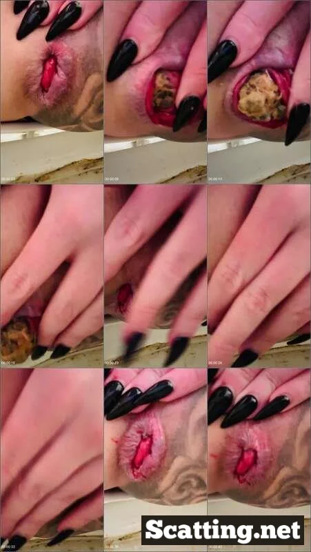 Anal Scat with Taylor Nicole - Look at that prolapse!