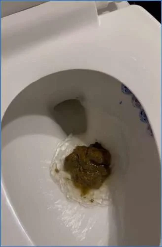 Kaitlyn Katsaros in Holy Fuck Lol: Hardcore Fisting and Real Anal Scat