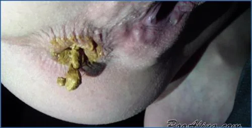 PooAlina vomits and poops in shoe while farting